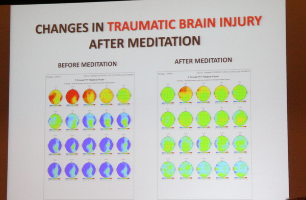 Joe Dispenza slide ICPA